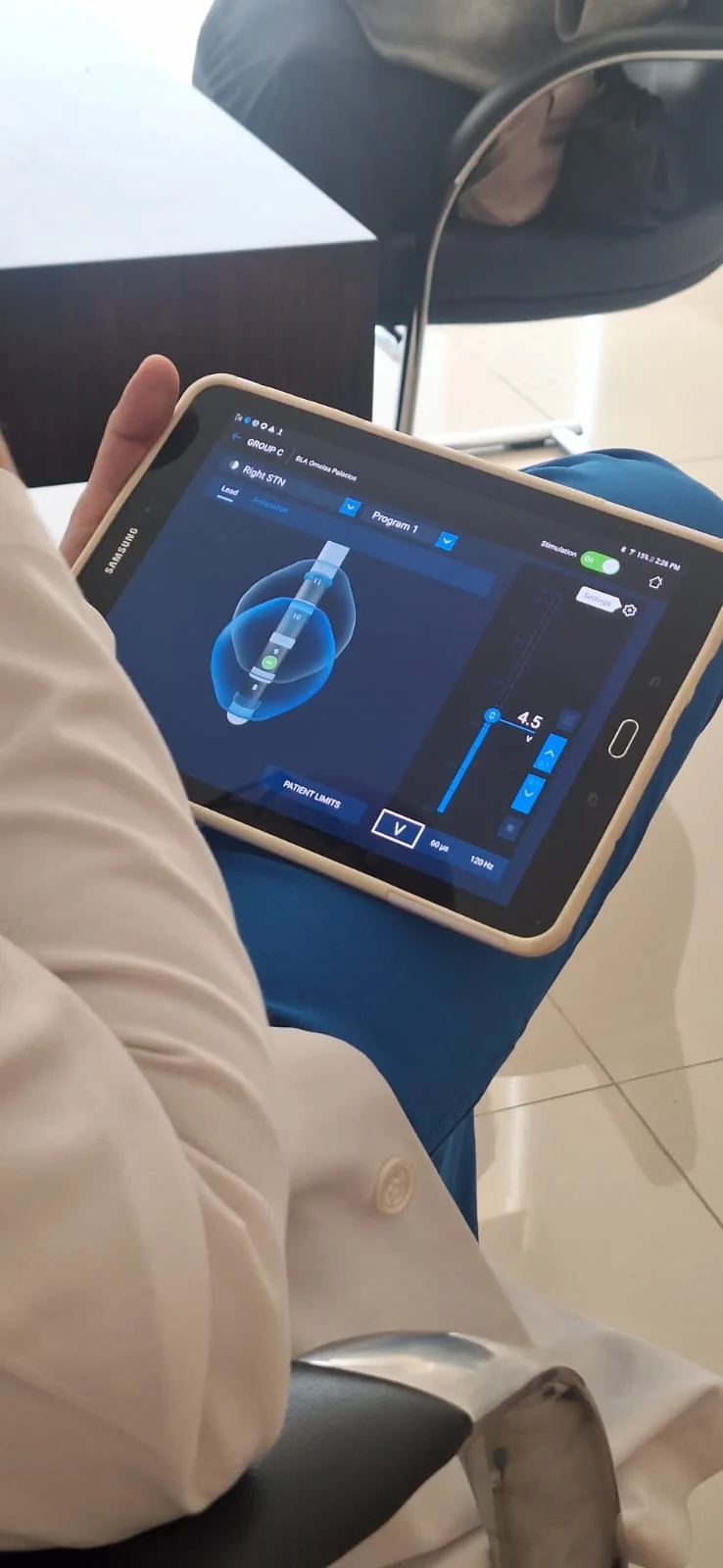 Programación de estimulación cerebral profunda